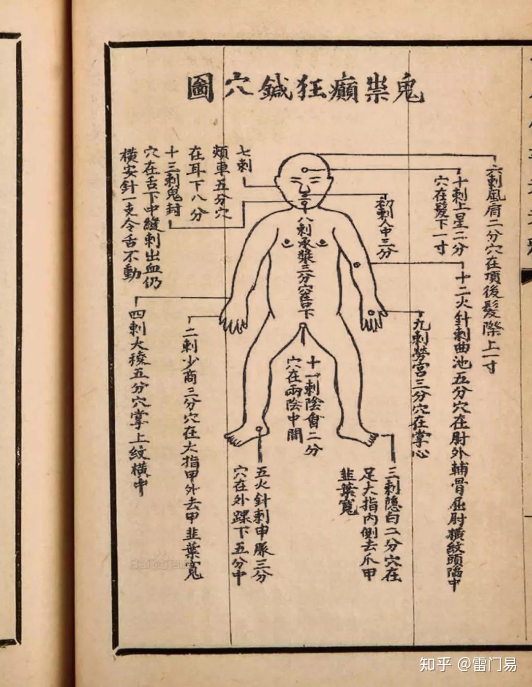 鬼门十三针